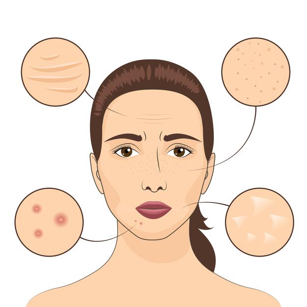 How to Get Rid of Acne Scars, According to Dermatologists?