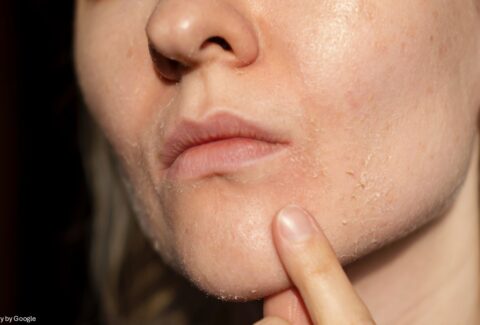 what causes dry skin