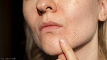 Top 10 Tips for Relieving Dry Skin