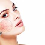 Top 10 Tips for Relieving Dry Skin