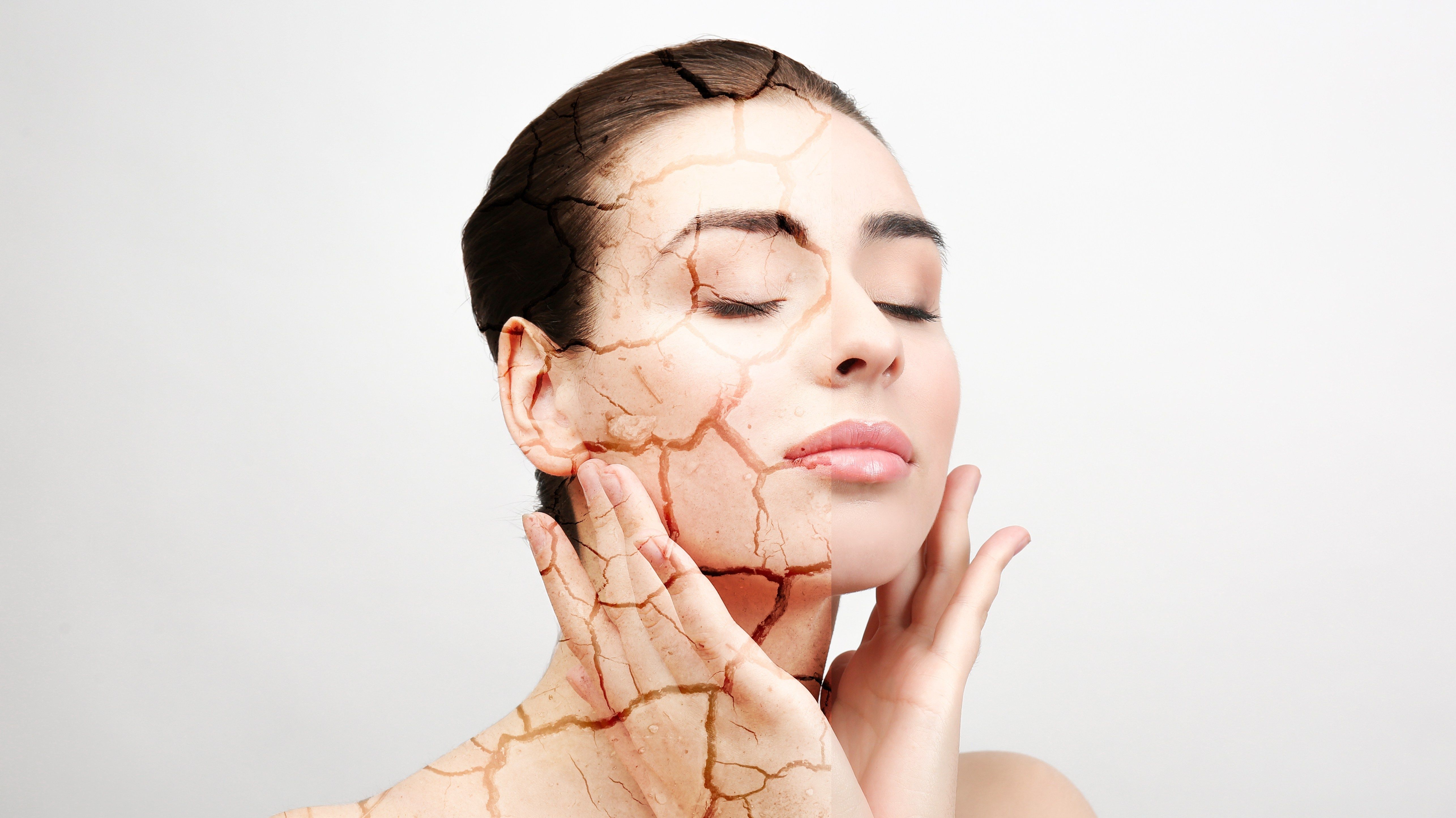 Top 10 Tips for Relieving Dry Skin Image 2