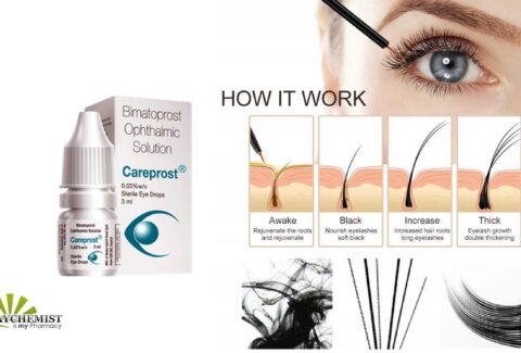 Top Benefits of Using Careprost 1