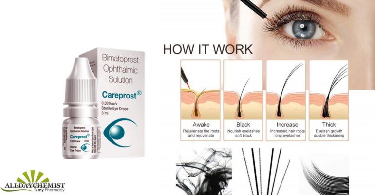Top Benefits of Using Careprost 1