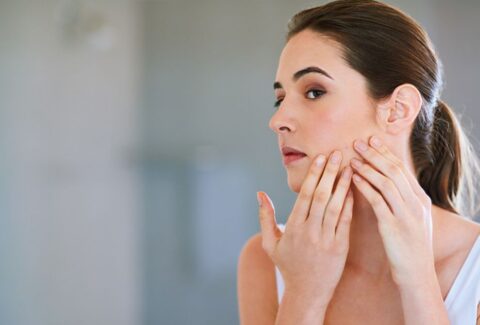 Acne on Skin