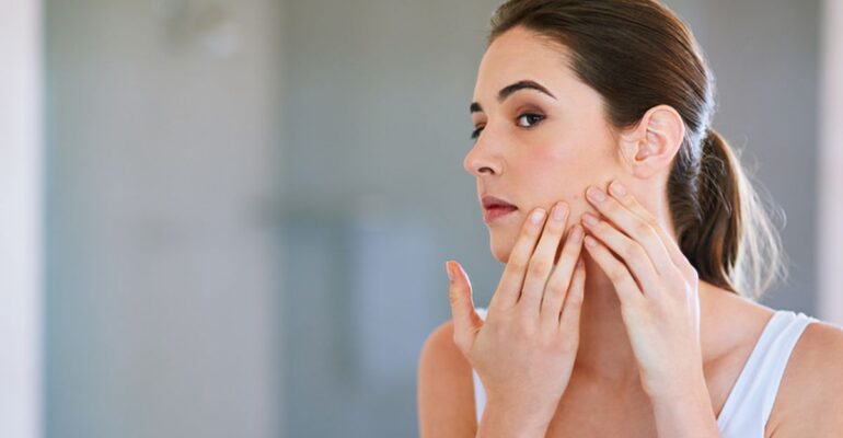 Acne on Skin
