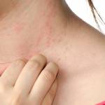 What Are Common Causes Of Skin Problems? How To Avoid Skin Problems?
