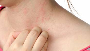 What Are Common Causes Of Skin Problems? How To Avoid Skin Problems?