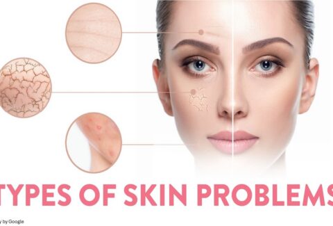 types of skin rashes