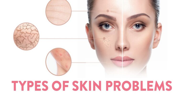 types of skin rashes