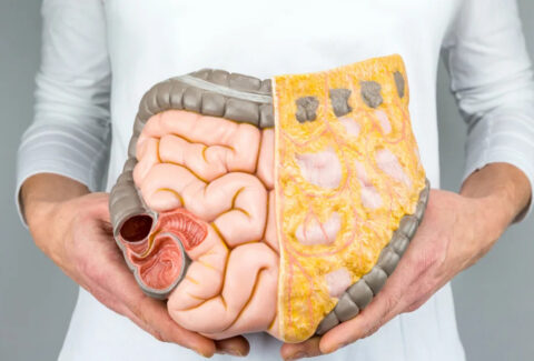 Castrointestinal Medicine