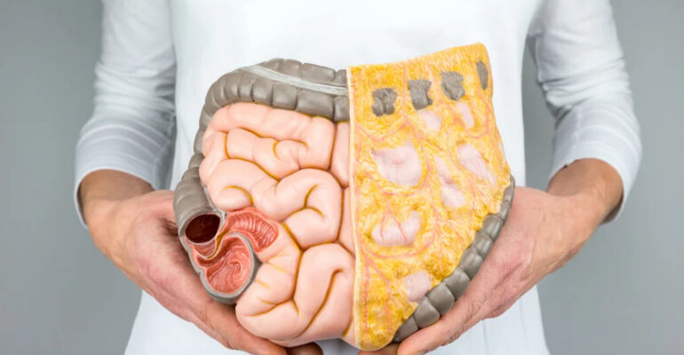 Castrointestinal Medicine