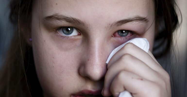 how to take care of pink eye