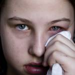 How to Take Care Of Pink Eye?