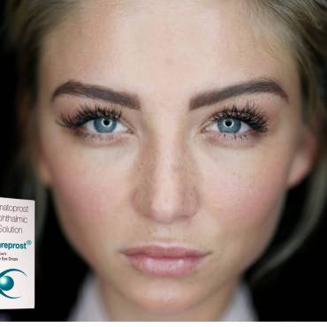 Know About Careprost and Bimatoprost