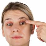 Understand Everything About Chalazion