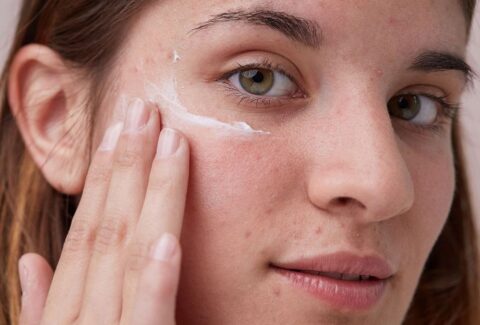 Step-by-Step Guide: Achieve Acne Prone Skin in 7 Days