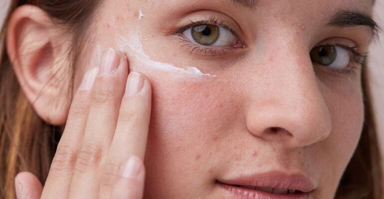 Step-by-Step Guide: Achieve Acne Prone Skin in 7 Days