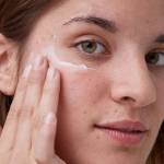 How to treat acne-prone skin in 7 days?