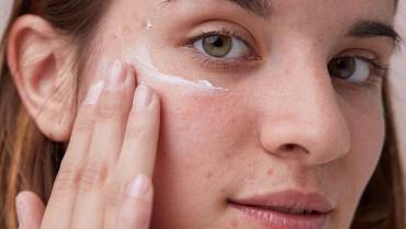 How to treat acne-prone skin in 7 days?