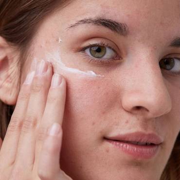 How to treat acne-prone skin in 7 days?