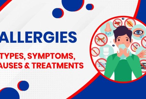 Unraveling Allergies: Causes, Symptoms, and Treatment Explained