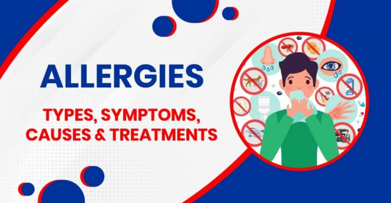 Unraveling Allergies: Causes, Symptoms, and Treatment Explained