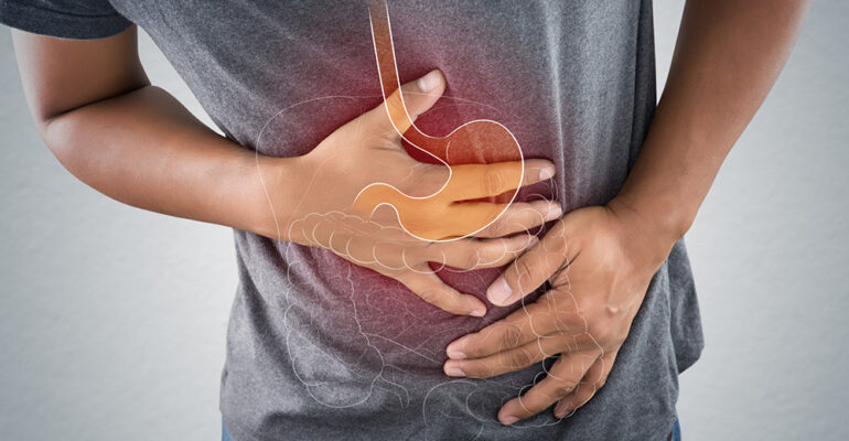Person standing with acid reducers: Illustration showcasing PPIs, H2 blockers, and healthy digestion.