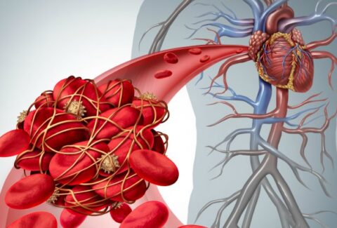 role of anticoagulants in preventing blood clots
