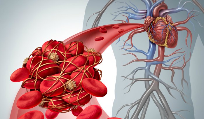 role of anticoagulants in preventing blood clots