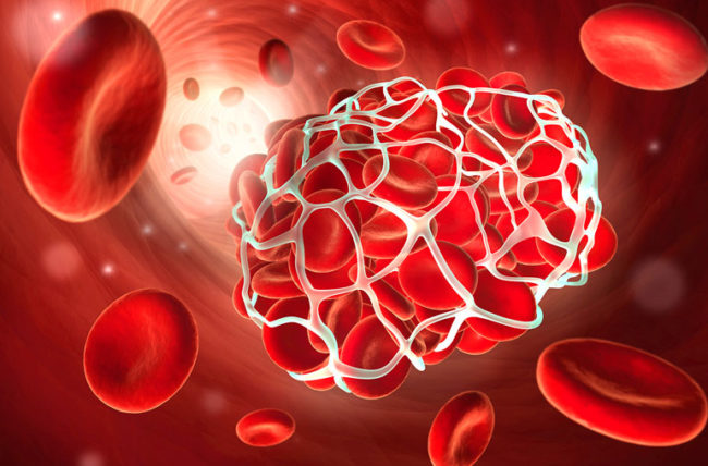 Image depicting the significance of anticoagulants in the prevention of blood clots.