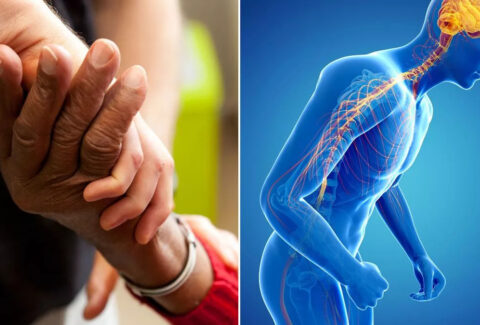 The effectiveness of treatment for Parkinson's disease in its early stages.