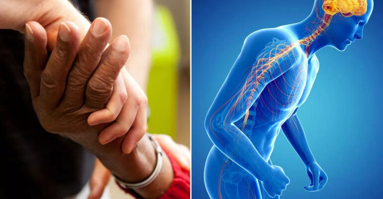The effectiveness of treatment for Parkinson's disease in its early stages.