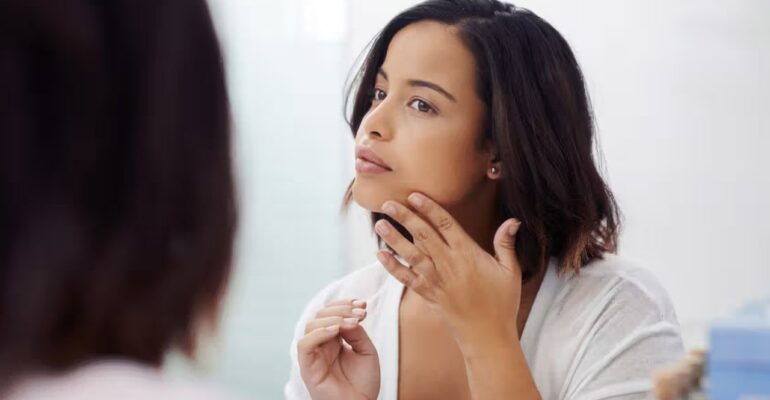 Person using Melalite Forte Cream for Skincare