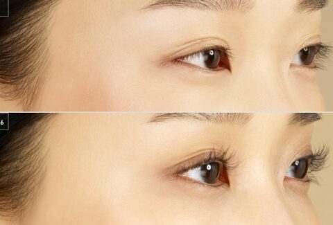 careprost eyelash