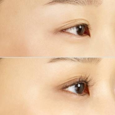 Careprost vs. Other Eyelash Serums: Understanding the Differences