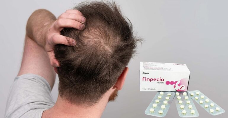 finpecia 1mg