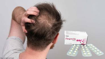 Finpecia 1mg vs. Other Hair Loss Treatments: A Detailed Comparison by All Day Chemist