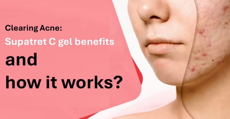 supatret gel 0.04