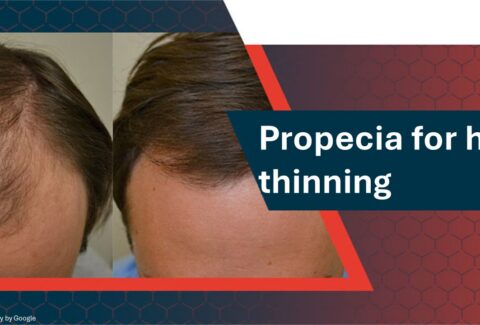 propecia for hair loss