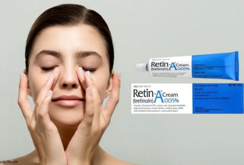 retin a cream before and after