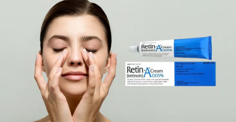 retin a cream before and after