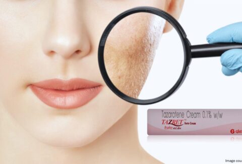 tazorac gel - all day chemist