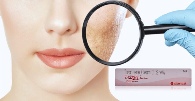 tazorac gel - all day chemist