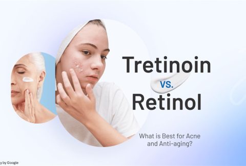 tretinoin before and after