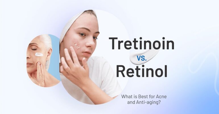 tretinoin before and after
