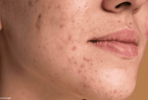 skin lightening cream - All Day Chemist