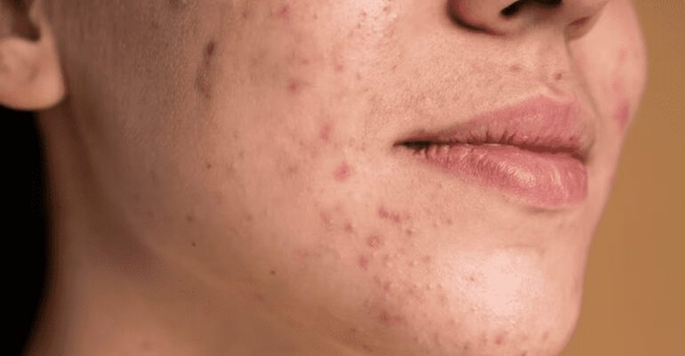 skin lightening cream - All Day Chemist