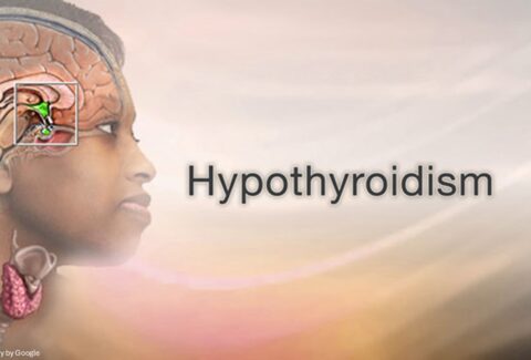what is hypothyroidism​ - All Day Chemist