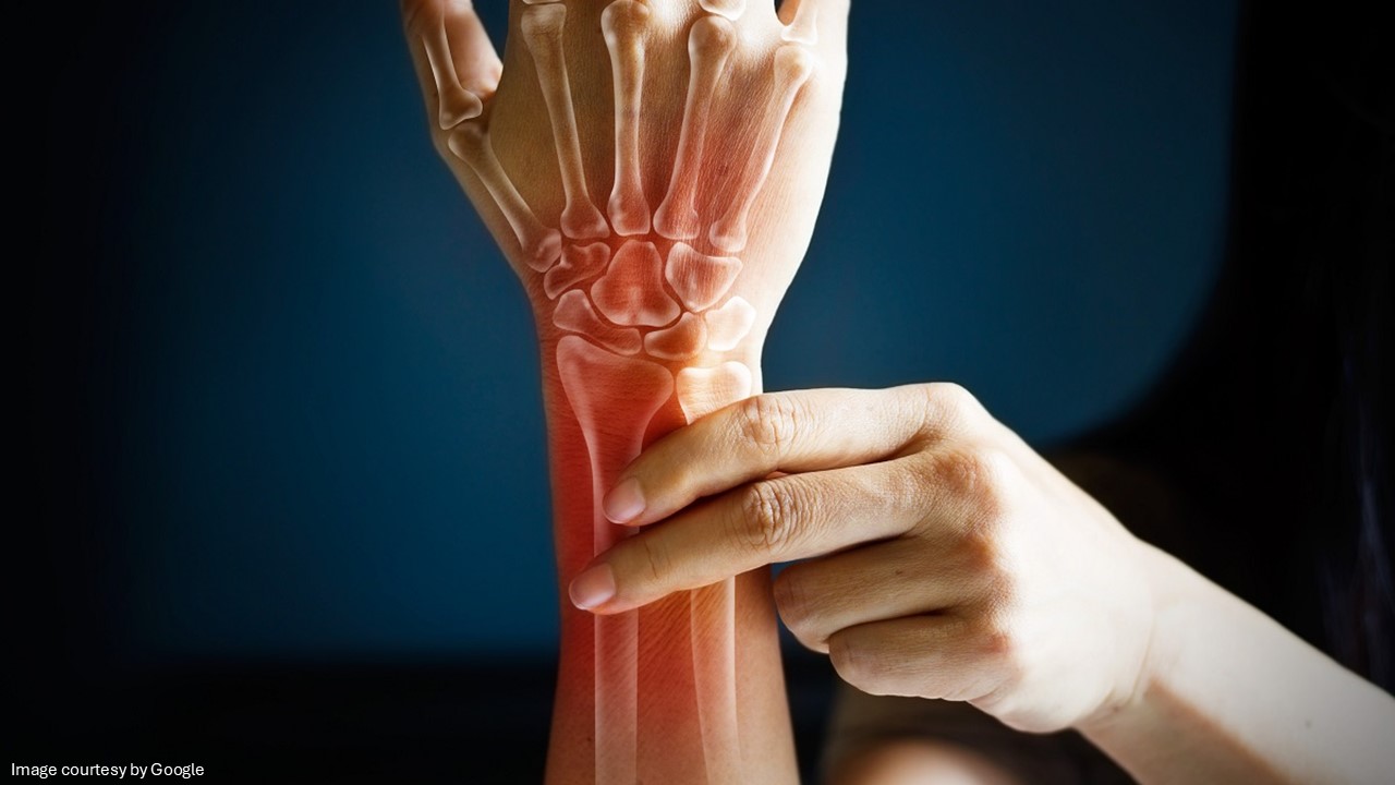 osteoporosis medications -ADC