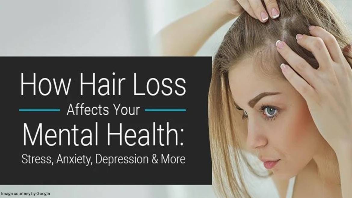 Coping with Hair Loss in Your 20s: Mental Health and Self-Image Tips